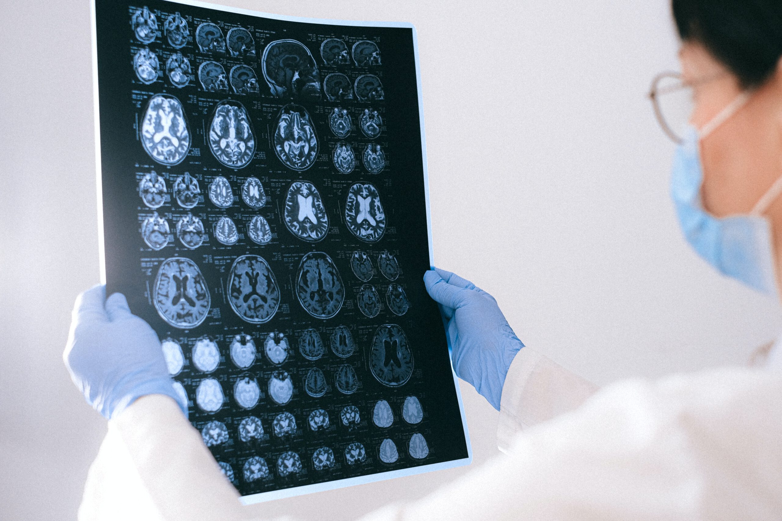 Doctor Reviewing Brain Injury X-Ray