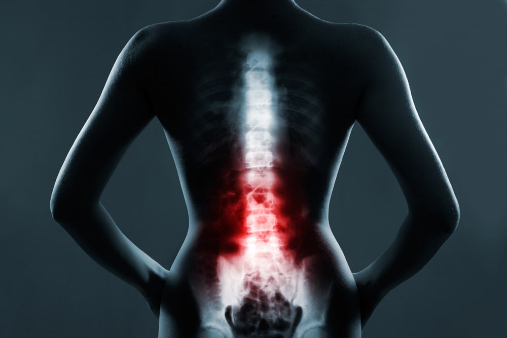 Illustration of spinal cord and lower back injury pain